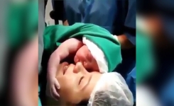 # Ce bébé refuse d’être séparé de sa mère à la naissance 💕