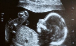 - 7 choses que bébé apprend avant même d’être né !