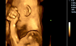 Que ressent le bébé si la mère pleure pendant la grossesse ? Une étude explique