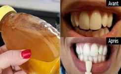 Une méthode rapide et efficace pour nettoyer les dents en moins d’une minute