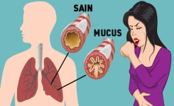 Comment se débarrasser du mucus dans vos poumons et votre gorge 