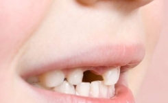 Les dentistes mettent en garde: ne jetez pas les dents de lait! Cela peut sauver la vie de votre enfant!
