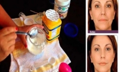 Cette femme a utilisé cette incroyable crème faite maison pendant une semaine et 50% des rides de son visage ont disparu 
