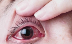 Il a été diagnostiqué avec le cancer de l’oeil à cause de cette habitudes que vous faites probablement tous les soirs… 