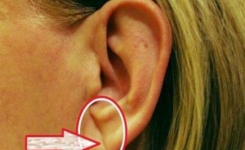 Si vous avez une ligne ou un pli dans les lobes de vos oreilles