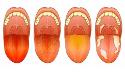Si vous observez ces 10 signes sur votre langue, voici ce qu’ils révèlent sur votre santé …