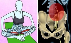 6 exercices faciles pour se débarrasser des maux de dos et des douleurs du nerf sciatique