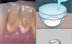 Éliminez Naturellement la Plaque Dentaire : Une Astuce Maison à Base de Bicarbonate de Soude, Sel et Citron