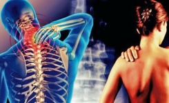 La cervicobrachialgie : cette douleur qui part du cou jusqu’au bras