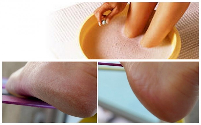 Astuce Naturelle Et Efficace Pour Traiter Les Pieds Secs Et Fendillés