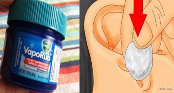6 Utilisations Insoupçonnées du Vicks VapoRub au Quotidien