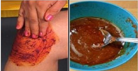 Recette naturelle pour apaiser les douleurs articulaires du genou