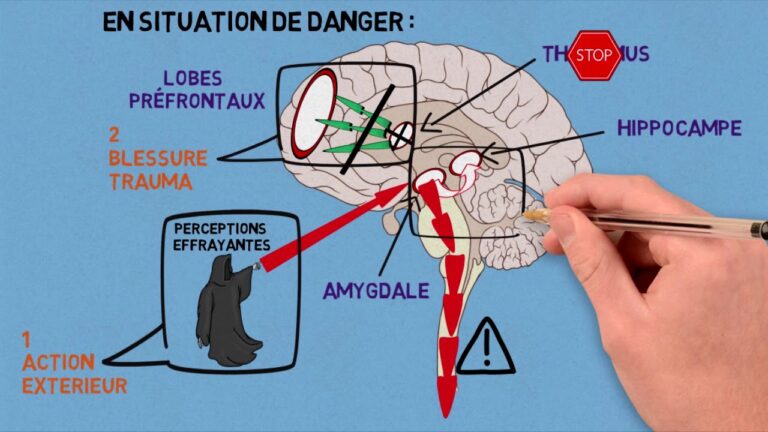 Comment le cerveau réagit face à un traumatisme