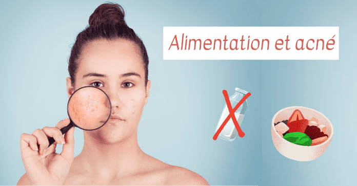 Quels sont les aliments qui donnent des boutons et pourquoi ?