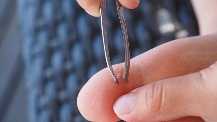 Comment enlever une écharde dans le pied, le doigt ou la main ?